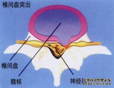 性障碍勃起的有效治疗